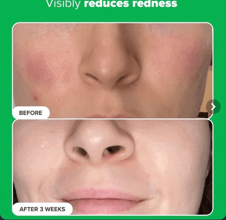 کرم ضدلک آزلائیک اسید ۱۰٪ پائولاز چویس | Paula’s Choice 10% Azelaic Acid Booster